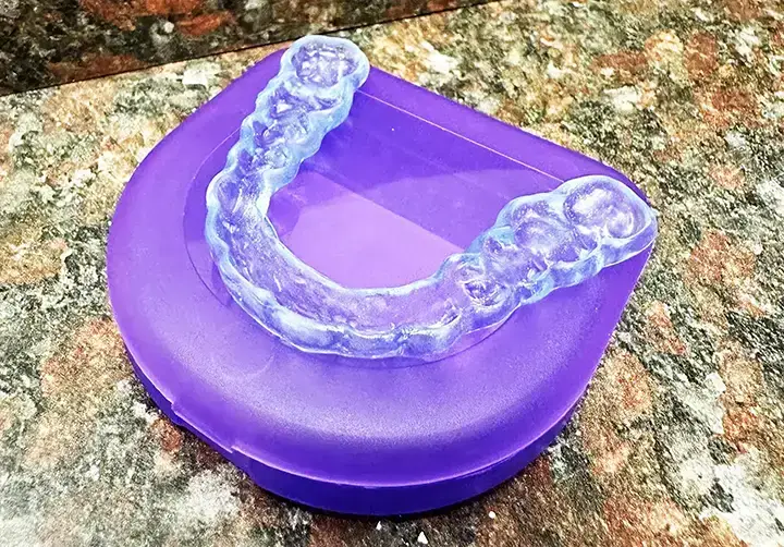 Invisalign-Near-Me-in-Thornton