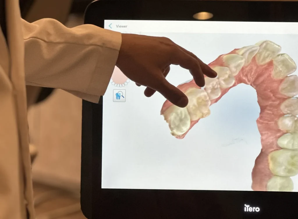 Single Arch Dental Implants Near Westminster CO