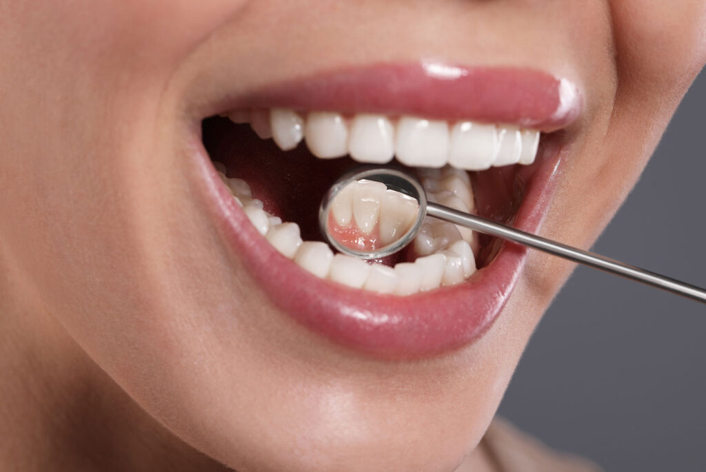 oral cancer screening illustration