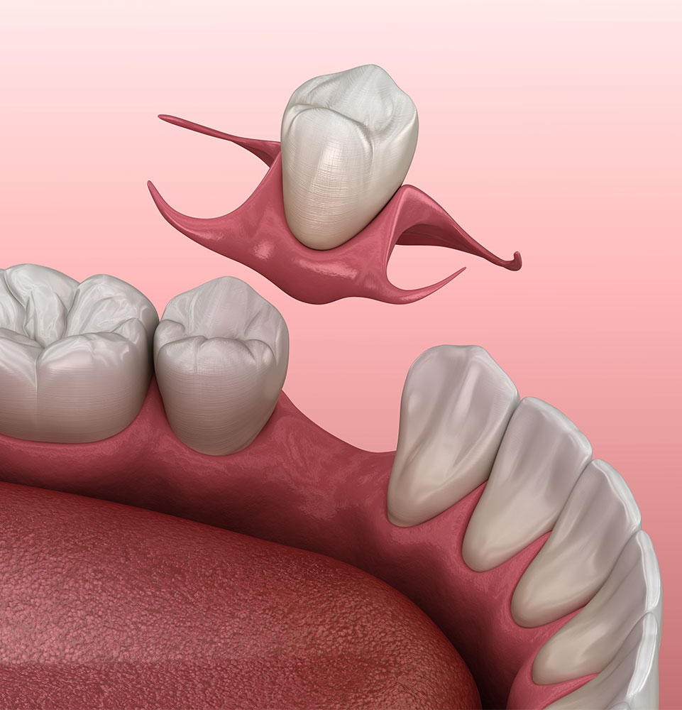 Immediate Dentures - Dentist Examination